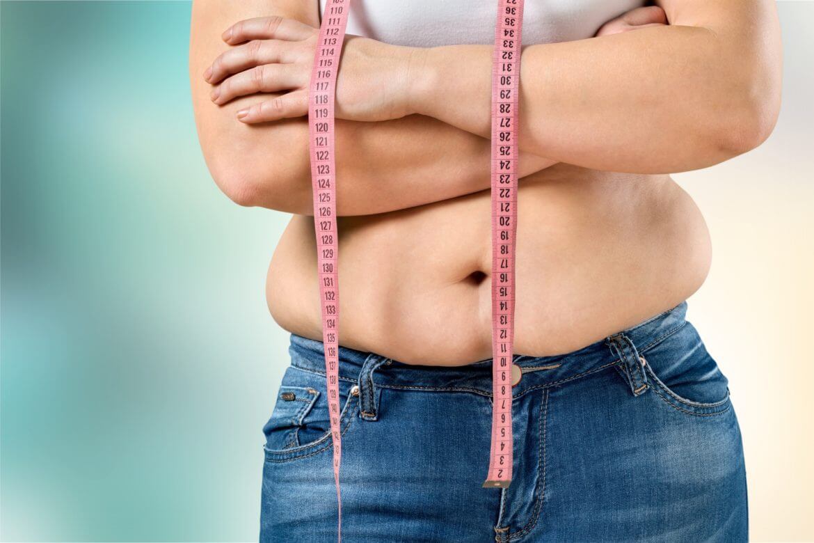 Can I Get CoolSculpting if I Am Overweight?